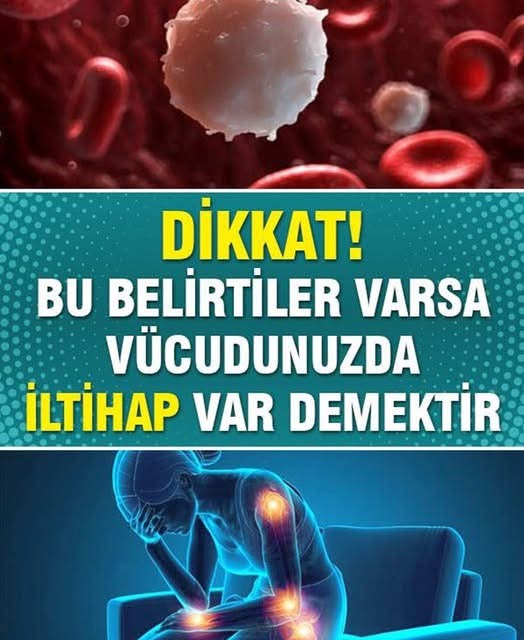 Vücuttaki iltihabın belirtileri vücudun