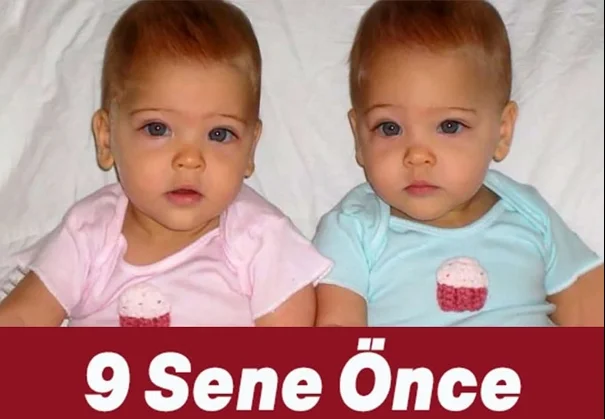 Şimdiki Halini Görenler İnanamıyor