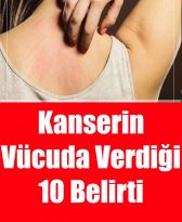 Kanserin Vücuda Verdiği 10 Belirti