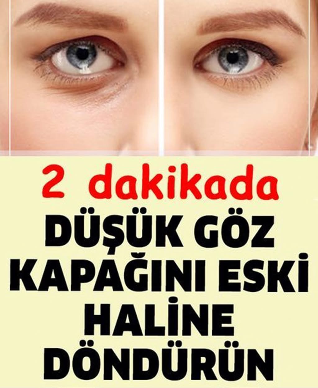 Düşük Göz Kapağını Eski Haline Getirmenin Püf Noktası