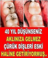Dişçiye Gitmemek İçin Dişlerinizi Bu Yağ ile Fırçalayın