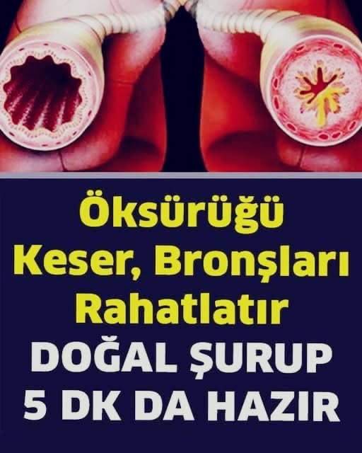 Öksürüğün Gribin Bronşitin ve Astımın Şifası Bu