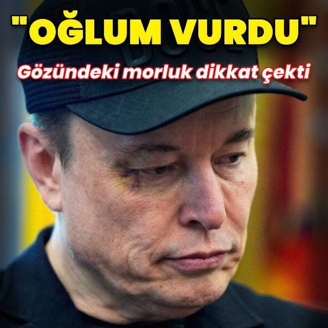 Oğlum X yaptı